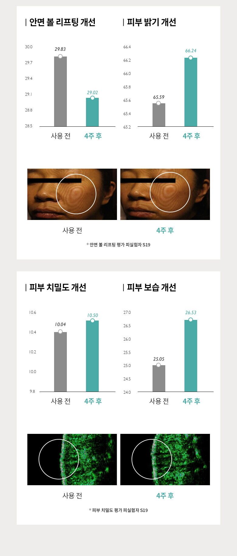 제나벨_에델바이스_상세페이지(780)_220701_HE_09
